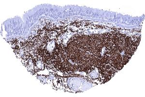Bronchus mucosa High content of elastin fibres along the bronchus mucosa (Recombinant Elastin anticorps)