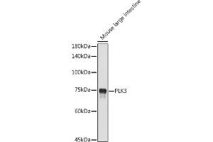 Western blot analysis of extracts of Mouse large intestine, using PLK3 antibody (ABIN6130232, ABIN6145779, ABIN6145780 and ABIN6224749) at 1:1000 dilution. (PLK3 anticorps  (AA 487-646))