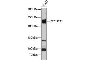 Western blot analysis of extracts of 293T cells, using ZCCHC11 Antibody (ABIN6128939, ABIN6150406, ABIN6150407 and ABIN6221650) at 1:3000 dilution. (ZCCHC11 anticorps  (AA 1-290))
