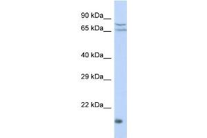 Host: Rabbit Target Name: ZNF195 Sample Type: HepG2 Whole cell lysates Antibody Dilution: 1. (ZNF195 anticorps  (N-Term))
