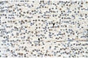 Immunohistochemical staining (Formalin-fixed paraffin-embedded sections) of human brain with GAPVD1 polyclonal antibody  at 4-8 ug/mL working concentration. (GAPVD1 anticorps  (N-Term))