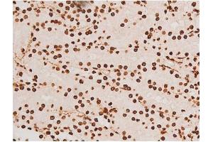 ABIN6267604 at 1/200 staining Rat kidney tissue sections by IHC-P.