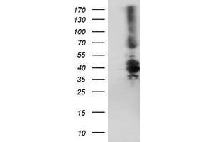 HEK293T cells were transfected with the pCMV6-ENTRY control (Left lane) or pCMV6-ENTRY DTNB (Right lane) cDNA for 48 hrs and lysed. (Dystrobrevin beta anticorps)