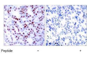 Image no. 2 for anti-Jun Proto-Oncogene (JUN) (Ser243) antibody (ABIN197137) (C-JUN anticorps  (Ser243))