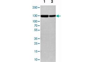 Western blot analysis of cell lysates with CFB polyclonal antibody . (Complement Factor B anticorps)