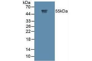 Figure. (MMP11 anticorps  (AA 277-488))