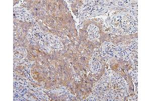 IHC analysis of CDK1 using anti-CDK1 antibody (ABIN7602240). (CDK1 anticorps  (AA 66-297))