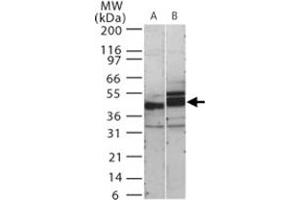 Western blot analysis of human SIGIRR in 15 ugs of (A) human kidney and (B) mouse kidney cell lysate. (SIGIRR anticorps  (AA 334-358))