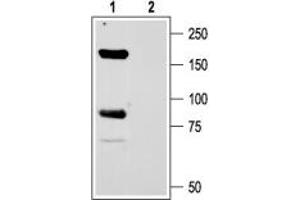 Expression of ASIC1 in rat brain - Immunohistochemical staining of rat globus pallidus using Anti-ASIC1 Antibody (ABIN7042915, ABIN7045236 and ABIN7045237).