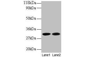 Western blot All lanes: MRPL9 antibody at 2 μg/mL Lane 1: EC109 whole cell lysate Lane 2: 293T whole cell lysate Secondary Goat polyclonal to rabbit IgG at 1/15000 dilution Predicted band size: 31 kDa Observed band size: 31 kDa (MRPL9 anticorps  (AA 60-267))