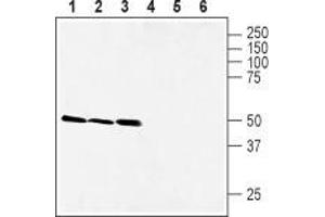 Western blot analysis of rat brain (lanes 1 and 4), mouse brain (lanes 2 and 5) and rat stomach (lanes 3 and 6) lysates: - 1-3.