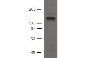 Image no. 1 for anti-Desmoglein 2 (DSG2) (AA 37-164) antibody (ABIN1169682) (Desmoglein 2 anticorps  (AA 37-164))