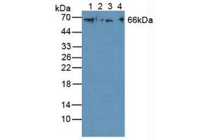 Figure. (Cytokeratin 1 anticorps  (AA 487-644))