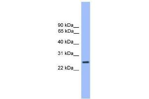 Western Blot showing GOSR1 antibody used at a concentration of 1-2 ug/ml to detect its target protein. (GS28 anticorps  (C-Term))