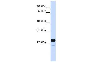 C1QTNF1 antibody used at 1 ug/ml to detect target protein. (C1QTNF1 anticorps  (N-Term))