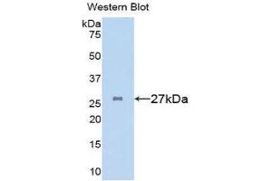 Western Blotting (WB) image for anti-Clusterin (CLU) (AA 227-447) antibody (ABIN3207141) (Clusterin anticorps  (AA 227-447))