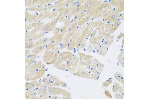 Immunohistochemistry of paraffin-embedded mouse heart using TGM5 antibody at dilution of 1:200 (40x lens). (Transglutaminase 5 anticorps)
