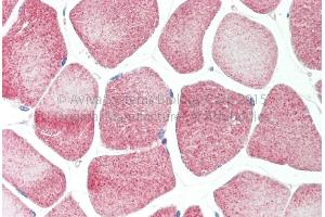 Rabbit Anti-RRP8 Antibody Catalog Number: ARP68566 Formalin Fixed Paraffin Embedded Tissue: Human Adult Skeletal muscle  Observed Staining: Cytoplasm in hepatocytes Primary Antibody Concentration: 1:600 Secondary Antibody: Donkey anti-Rabbit-Cy3 Secondary Antibody Concentration: 1:200 Magnification: 20X Exposure Time: 0.