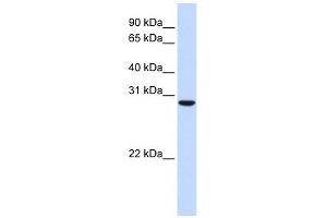 C18ORF10 antibody used at 1 ug/ml to detect target protein. (TPGS2 anticorps  (Middle Region))