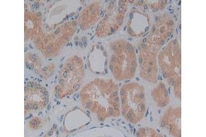 IHC-P analysis of Human Tissue, with DAB staining. (DBN1 anticorps  (AA 3-134))