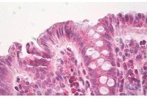 Image no. 2 for anti-Heparanase (HPSE) (AA 68-117) antibody (ABIN6749776)