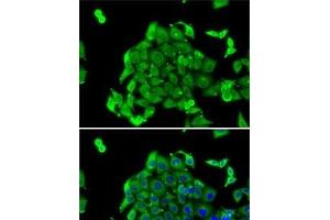 Immunofluorescence analysis of MCF7 cells using RPS14 Polyclonal Antibody (RPS14 anticorps)