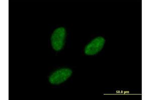 Immunofluorescence of purified MaxPab antibody to IRAK1BP1 on HeLa cell. (IRAK1BP1 anticorps  (AA 1-260))