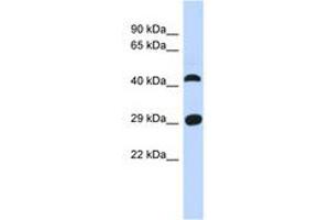Image no. 1 for anti-Chromosome 4 Open Reading Frame 22 (C4orf22) (AA 35-84) antibody (ABIN6741345) (C4orf22 anticorps  (AA 35-84))