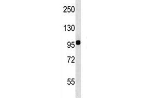 Integrin beta 7 antibody western blot analysis in WiDr lysate.