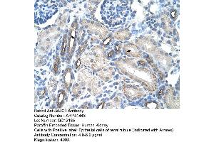 Rabbit Anti-MUC1 Antibody  Paraffin Embedded Tissue: Human Kidney Cellular Data: Epithelial cells of renal tubule Antibody Concentration: 4. (MUC1 anticorps  (C-Term))