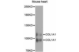Western blot analysis of extracts of mouse heart, using COL1A1 antibody (ABIN5997480) at 1/1000 dilution. (COL1A1 anticorps)