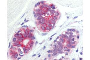Anti-WNT6 antibody IHC of human breast, epithelium cells.