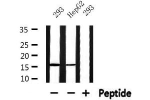 Western blot analysis of extracts from HepG2 and 293, using RPS19 Antibody. (RPS19 anticorps  (Internal Region))