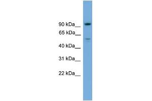 WB Suggested Anti-C16orf71 Antibody Titration: 0. (C16ORF71 anticorps  (Middle Region))