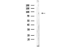 Western blot analysis of lysates from Rat brain, using Phospho-NR3C1 (Ser203) Antibody at 1/1000 dilution.