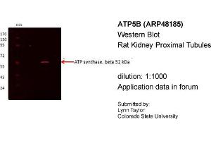Western Blotting (WB) image for anti-ATP Synthase, H+ Transporting, Mitochondrial F1 Complex, beta Polypeptide (ATP5B) (N-Term) antibody (ABIN2783268)