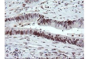 Image no. 4 for anti-tRNA Methyltransferase 2 Homolog A (TRMT2A) antibody (ABIN1501516)