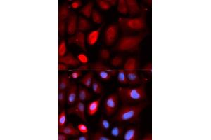 Immunofluorescence analysis of U20S cell using PDLIM5 antibody. (PDLIM5 anticorps)