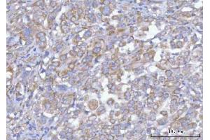 IHC analysis of Hamartin/TSC1 using anti-Hamartin/TSC1 antibody (ABIN7599499). (TSC1 anticorps  (AA 1-618))
