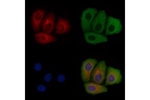 ABIN6258410 and ABIN6275557 staining Hela cells by IF/ICC.