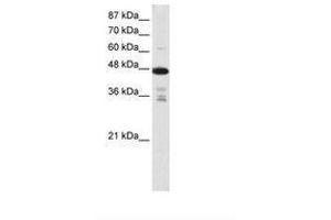 Image no. 2 for anti-Protein Arginine Methyltransferase 2 (PRMT2) (N-Term) antibody (ABIN203135) (PRMT2 anticorps  (N-Term))