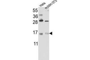 Western Blotting (WB) image for anti-RNA Binding Motif Protein 3 (RBM3) antibody (ABIN3003187) (RBM3 anticorps)