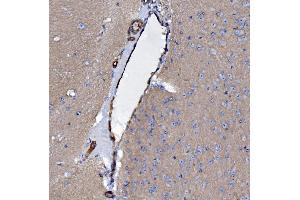 IHC analysis of EHD3 using anti-EHD3 antibody (ABIN7602777). (EHD3 anticorps  (C-Term))