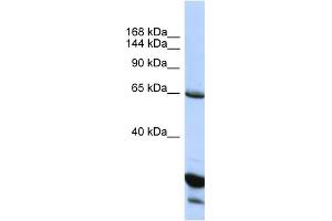 Host:  Rabbit  Target Name:  UNC5C  Sample Type:  HepG2 Whole Cell lysates  Antibody Dilution:  1. (Unc5c anticorps  (C-Term))