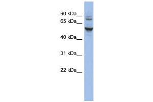 WB Suggested Anti-CECR6 Antibody Titration:  0. (CECR6 anticorps  (N-Term))