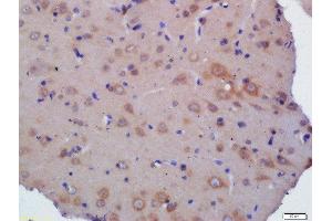 Formalin-fixed and paraffin embedded  labeled with Rabbit Anti- Polyclonal Antibody, Unconjugated at 1:200 followed by conjugation to the secondary antibody and DAB staining (Kelch-Like 24 anticorps  (AA 1-100))