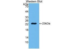 Western Blotting (WB) image for anti-Peptidoglycan Recognition Protein 1 (PGLYRP1) (AA 22-196) antibody (ABIN3204214) (PGLYRP1 anticorps  (AA 22-196))