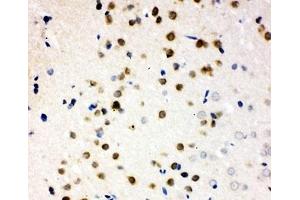 IHC-P testing of PLK2 antibody and rat brain tissue (PLK2 anticorps  (C-Term))