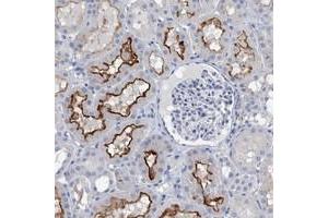 Immunohistochemical staining of human kidney with SLC34A3 polyclonal antibody  shows distinct membranous positivity in cells in tubules at 1:20-1:50 dilution.
