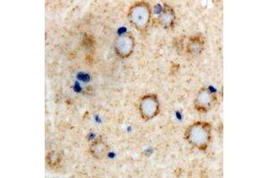 Immunohistochemical analysis of GLUR4 staining in human brain formalin fixed paraffin embedded tissue section. (GRIA4 anticorps  (C-Term))